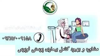 داستان درمان لوپوس بیماری پوستی خود ایمنی