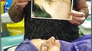 جراحی بینی استخوانی قوزدار