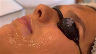 آموزش ژل کربوکسی