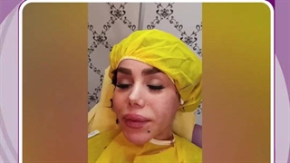 مادلینگ و زاویه سازی صورت با نخ