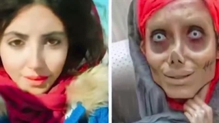 بدترین جراحی های پلاستیک زنی که جفت دست و پاشو از دست داد