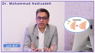 توضیحات دکتر هادیزاده در مورد حجم دهی سینه با تزریق ژل یا چربی پالپوتومی
