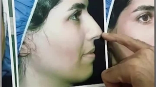 بلافاصله پس از جراحی بینی غضروفی قوزدار با نوک پهن