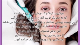 میکرونیدلینگ ترمیم سوختگی
