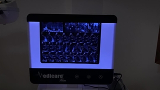 فیلم ایمپلنت دندان