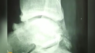 مرگ تالوس-02