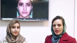 رضایت زیباجو از جراحی بینی گوشتی