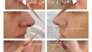 دکتر فریدون اسفندیاری در کرمانشاه برداشتن توده