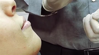 کاشت و ترمیم تخصصی مو اقساط در تهران توسط دکتر کامران دلیر