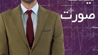 کاشت مو به روش  SUT و خدمات زیبایی اقساطی توسط دکتر کامران دلیر