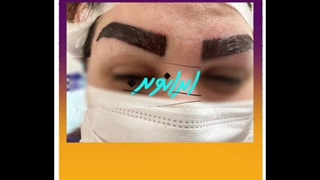 کاشت ابرو قسطی!!