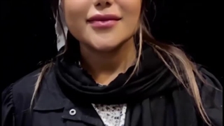 شش ماه بعد از جراحـــی زیبــایی بینـــی همراه عزیز مطب