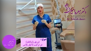 تزریق ژل فیلتر