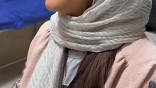 پنج ماه بعد از عمل جراحی زیبایی بینی ، طبیعی و نچرال - دکتر مسعود جانی پور جوانسازی پوست