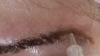 ریمو تاتو ۲۰ ساله