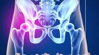 روش ایستادن پس از جراحی تعویض مفصل ران