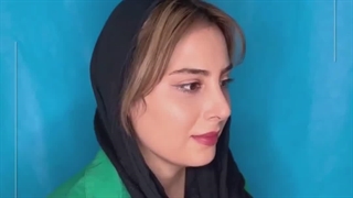 بعد از جــراحی بینی طبیعی زیباجوی قشنگ مــون