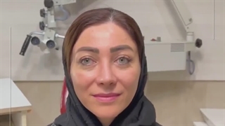 جراحی بینی به این نچرالی و زیبایی دیده بودین؟