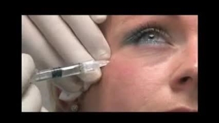 آموزش تزریق ژل پرفکتا فاین لاین