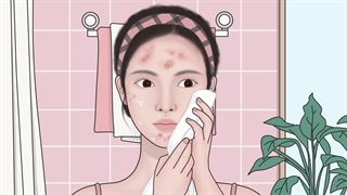 پاکسازی جوش مزوتراپی