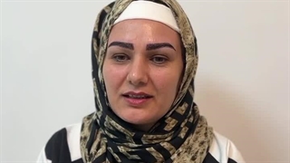 کاشت ابرو در تهران