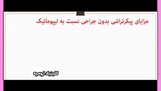 هزینه عمل لیپوماتیک