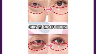 پف اطراف چشم