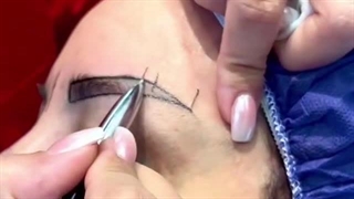 کلینیک کاشت مو و ابرواورامان