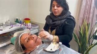 آموزش تزریق فیلرو بوتاکس تخصصی با تکنیک جدید