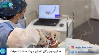 اسکن دیجیتال لمینت دندان در شیراز - دکتر نگین اثنی عشری