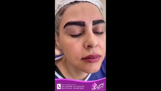 کاشت ابرو طبیعی با ماندگاری بالا – نمونه کارهای واقعی، زیبایی بی‌نظیر! 