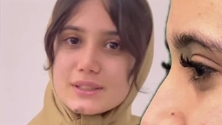 دکتر زاعی حسین زاده - بهترین جراح بینی ساری