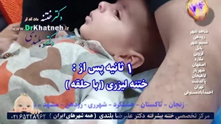 ختنه نوزاد پسر کرج