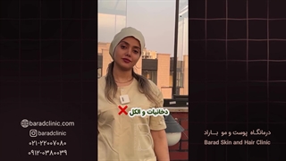 رعایت مراقبت های قبل از کاشت مو