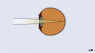 چگونگی مراقبت از چشم