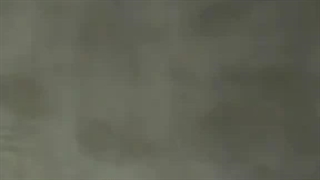 سونو انهایپن