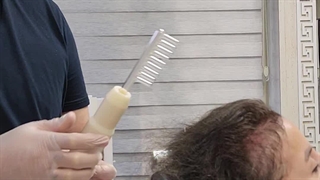 اوزون تراپی در کلینیک آوینا