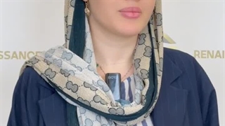 کاشت ابرو بدون جراحی به روش sut